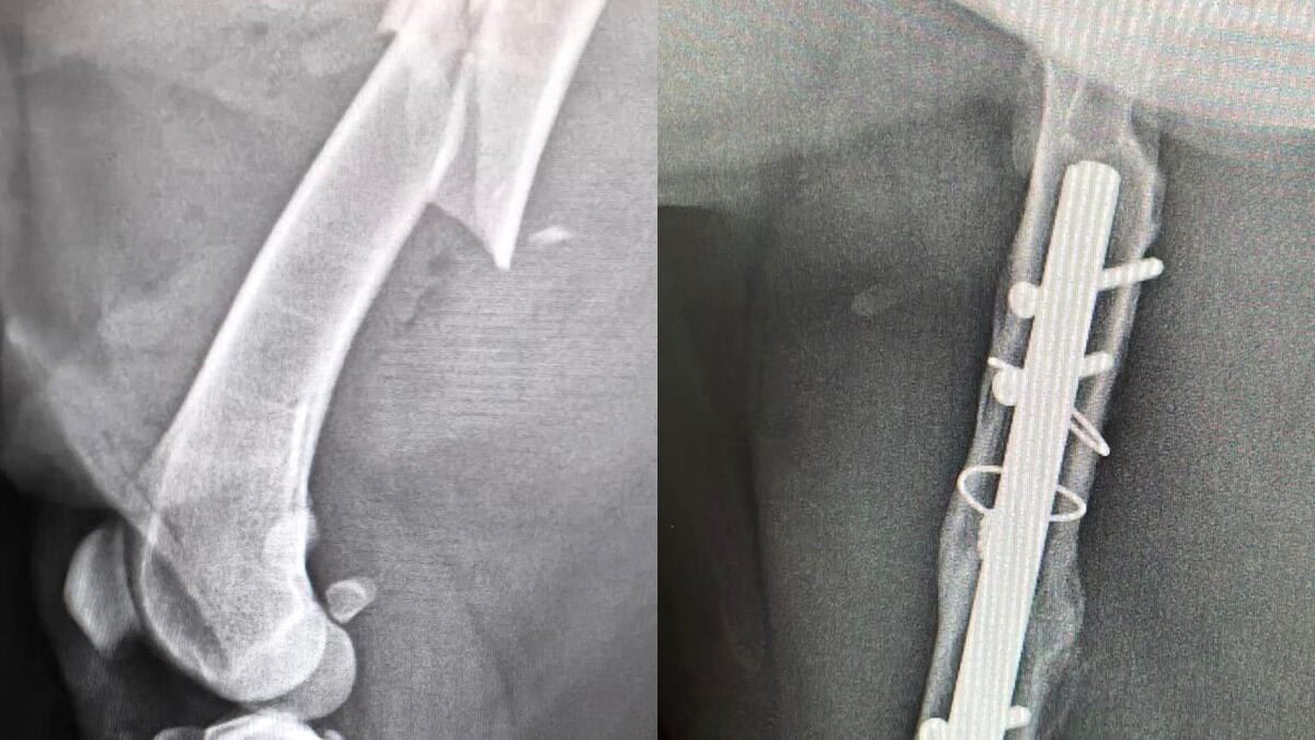 Radiografía de la fractura de fémur sufrida por Tuba y material de osteosíntesis tras la cirugía